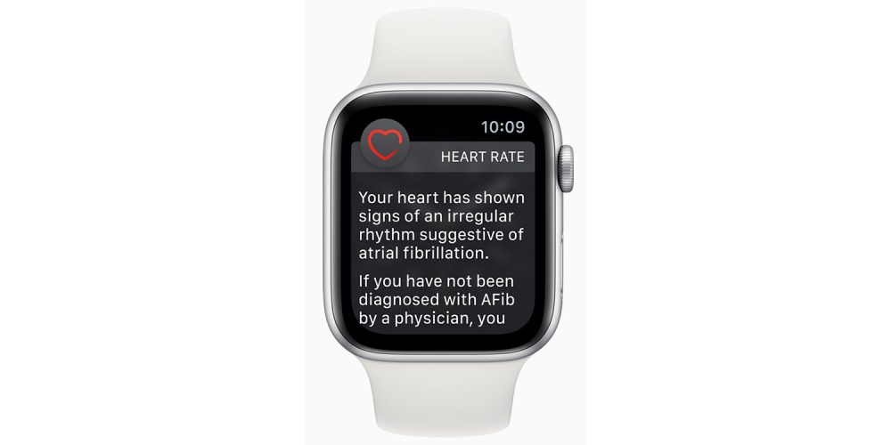 Apple Watch ne détecte pas AFib au-dessus de 120 bpm